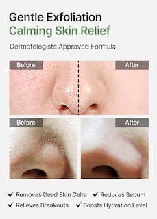 Foto 3 | Foto 3 | Almohadillas Tónicas Exfoliantes Celimax Ji.woo.gae Heartleaf Bha (60) - Venta Internacional.