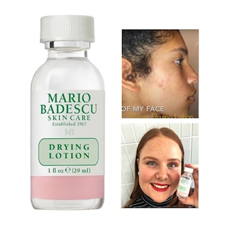 Foto 1 | Foto 1 | Loción Secante Para El Tratamiento Del Acné Mo Tulip 29 Ml - Venta Internacional.
