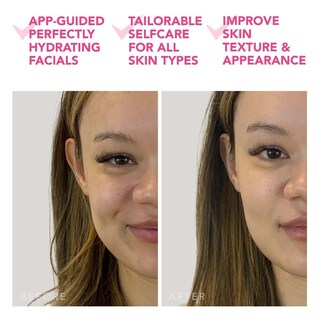 Foto 5 | Foto 5 | Dispositivo De Tratamiento Facial Foreo Ufo Mini 2 Red Light Therapy - Venta Internacional.