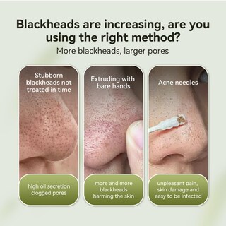 Foto 3 | Foto 3 | Mascarilla Removedora De Puntos Negros Lanbena Charcoal Peel-off 30 Ml - Venta Internacional.