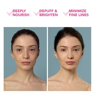 Foto 5 | Foto 5 | Crema Hidratante Facial Profunda Facial Spa Foreo Ufo 3 Con 5 En 1 - Venta Internacional.