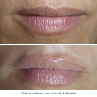 Foto 6 | Foto 6 | Mascarilla Facial Y Labial Bioelements Collagen Rehab 50 Ml Vegan - Venta Internacional.