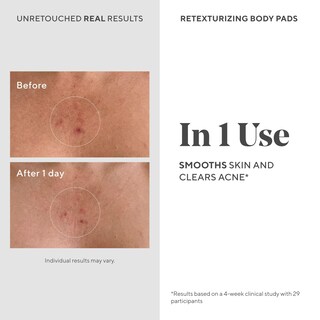 Foto 3 | Foto 3 | Almohadillas Faciales Y Corporales Murad Acne Retexturizing 45 Almohadillas - Venta Internacional.