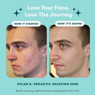 Foto 5 | Foto 5 | Kit De Tratamiento Para El Acné Proactiv De 3 Pasos Con Parches Para Espinillas, 90 Días - Venta Internacional.