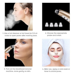 Foto 3 | Foto 3 | Máquina Limpiadora Facial Para Eliminar Puntos Negros Y Aspiradora De Acné - Venta Internacional.