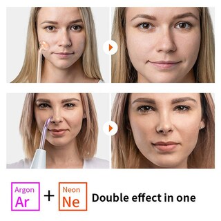 Foto 3 | Foto 3 | Aparato Facial Antienvejecimiento De Alta Frecuencia Facial Machine - Venta Internacional.