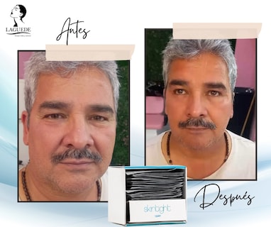 Foto 6 | Foto 6 | Skintight Laguede Tensor en Gel Natural De Arruga, Bolsas Bajo Los Ojos