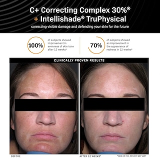 Foto 4 | Foto 4 | Complejo Corrector Serum Revision Skincare C+ 30% 30 Ml - Venta Internacional.
