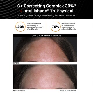 Foto 5 | Foto 5 | Complejo Corrector Serum Revision Skincare C+ 30% 30 Ml - Venta Internacional.