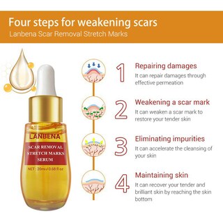 Foto 4 | Foto 4 | Serum Lanbena Para Eliminar Cicatrices De Acné Y Estrías 20 Ml - Venta Internacional.