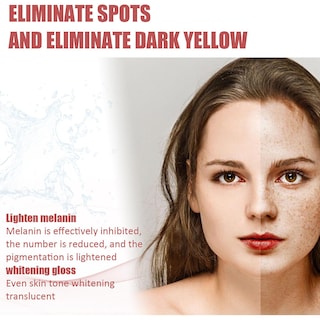 Foto 4 | Foto 4 | Crema Hidratante Huoguo Para Aclarar Las Pecas Del Melasma - Venta Internacional.