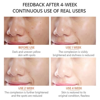 Foto 1 | Foto 1 | Facial Essence Huoguo Vitamina C 30 Ml Para Iluminar La Piel - Venta Internacional.