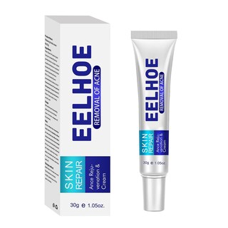 Foto 1 | Foto 1 | Crema Antiacné Pecas Y Blanqueadora 30g Huoguo - Venta Internacional.