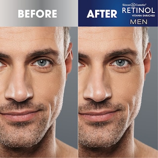 Foto 5 | Foto 5 | Crema Para Ojos Con Retinol, Tratamiento Original Para Hombres, Reduce La Hinchazón - Venta Internacional.