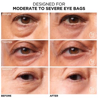 Foto 2 | Foto 2 | Tratamiento Diurno De Bolsas Para Debajo De Los Ojos It Cosmetics Bye Bye - Venta Internacional.
