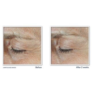 Foto 6 | Foto 6 | Crema Para Ojos Roc Derm Correxion Dual Con Retinol Y Péptidos 20 Ml - Venta Internacional.