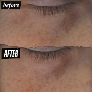 Foto 3 | Foto 3 | Sérum Para Ojos Kiehl's Powerful-strength Con 10% De Vitamina C, 15 Ml - Venta Internacional.