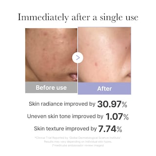 Foto 3 | Foto 3 | Herramienta Para El Cuidado De La Piel Facial Medicube Mini Booster Pro Pink - Venta Internacional.