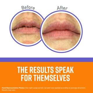 Foto 2 | Foto 2 | Lip Balm O'keeffe's Lip Repair Night Treatment 7 Ml (paquete De 2) - Venta Internacional.