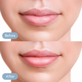 Foto 5 | Foto 5 | Máscara Labial Frudia Bálsamo Labial Teñido De Miel Y Mango Para Mujer, 10 Ml - Venta Internacional.