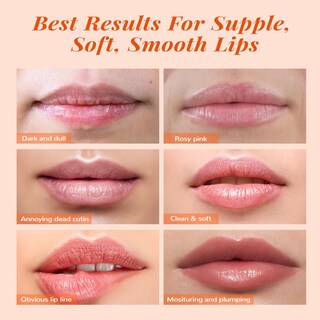 Foto 6 | Foto 6 | Set De Mascarilla Y Exfoliante Labial Anai Rui Lip Care Kit Peach - Venta Internacional.