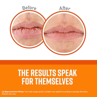 Foto 2 | Foto 2 | Bálsamo Labial Sin Perfume O'keeffe's Lip Repair Para Labios Secos (1 Paquete) - Venta Internacional.