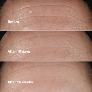 Foto 4 | Foto 4 | Serum Clinique Smart Clinical Repair Arrugas 100 ml - Venta Internacional