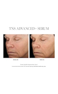 Foto 5 | Foto 5 | Serum Skinmedica Tns Advanced+ 30 Ml Antienvejecimiento Para Mujeres - Venta Internacional.