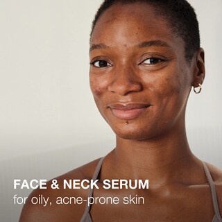 Foto 3 | Foto 3 | Sérum Rejuvenecedor Neutrogena Stubborn Texture 30 Ml Con Niacinamida Y Neoglucosamina - Venta Internacional.