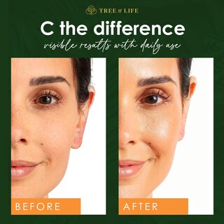 Foto 5 | Foto 5 | Sérum Tree Of Life Vitamina C 30 Ml Para Manchas Oscuras Y Arrugas - Venta Internacional.