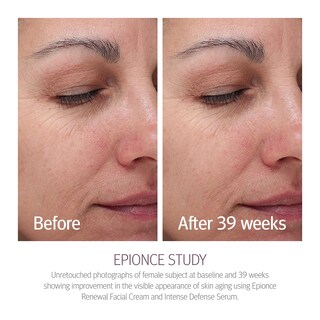 Foto 6 | Foto 6 | Crema Facial Renovadora Epionce Hidratante Antienvejecimiento Para Piel Seca - Venta Internacional.