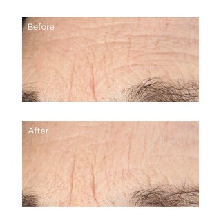 Foto 4 | Foto 4 | Sérum Perricone Md Essential Fx Con Acil-glutatión, Pliegue Profundo - Venta Internacional.