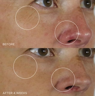 Foto 6 | Foto 6 | Serum Tatcha La Alternativa Al Retinol Suavizante De Arrugas De Seda - Venta Internacional.