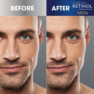 Foto 6 | Foto 6 | Crema Hidratante Con Retinol Para Hombres De Uso Diario Con Vitamina A Exfoliante - Venta Internacional.