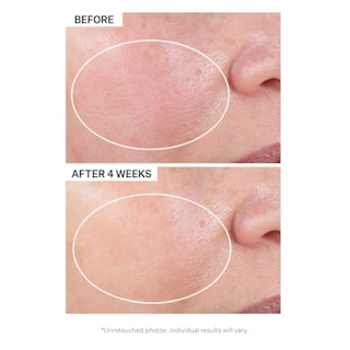 Foto 4 | Foto 4 | Crema Hidratante Nocturna Strivectin Advanced Retinol 50 Ml - Venta Internacional.