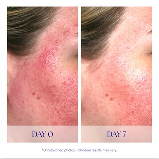 Foto 4 | Foto 4 | Sérum Is Clinical Pro-heal Advance+ Con Vitamina C, E, 15 Ml - Venta Internacional.