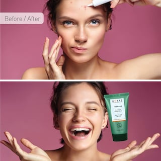 Foto 5 | Foto 5 | Crema Facial Moraz Polygonum Teenage Sin Aceite 50 Ml - Venta Internacional.