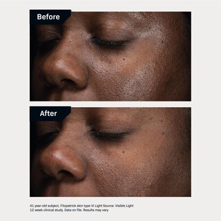 Foto 5 | Foto 5 | Serum Revision Skincare D·e·j Daily Boosting, 15 Ml, Antienvejecimiento - Venta Internacional.