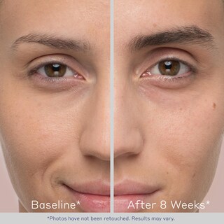 Foto 2 | Foto 2 | Sérum Potenciador De Cejas Obagi Medical Nu-cil, Paquete De 2 - Venta Internacional.