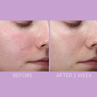 Foto 6 | Foto 6 | Sérum Kate Somerville Delikate Recovery 30 Ml Para Pieles Sensibles - Venta Internacional.