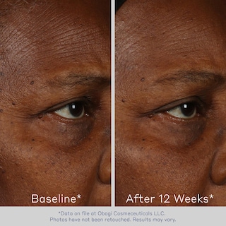 Foto 2 | Foto 2 | Sérum Facial Obagi Elastiderm Reafirmante Con Bimineral 30 Ml - Venta Internacional.
