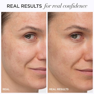 Foto 3 | Foto 3 | Crema Hidratante Antiedad Confidence In A Cream De It Cosmetics, 60 Ml - Venta Internacional.