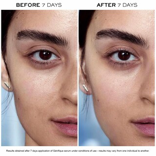 Foto 4 | Foto 4 | Sérum Facial Lancôme Advanced Génifique 50 Ml con Ácido Hialurónico - Venta Internacional