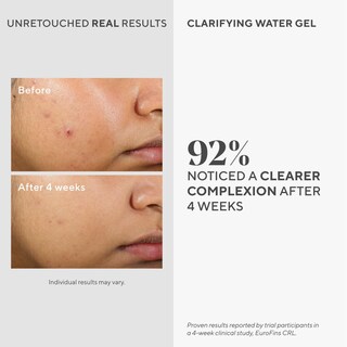 Foto 2 | Foto 2 | Gel de Agua Clarificante Hidratante Murad 60 ml para Rostro - Venta Internacional
