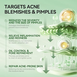 Foto 3 | Foto 3 | Sérum Para Manchas De Acné Lanbena Precision, Tratamiento Nocturno, 12 Ml - Venta Internacional.