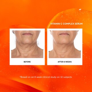 Foto 4 | Foto 4 | Serum Naturium Con Complejo De Vitamina C Para Rostro, 60 Ml, Con Ácido Hialurónico - Venta Internacional.