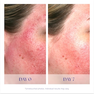 Foto 4 | Foto 4 | Serum Is Clinical Pro-heal Serum Advance+ Antioxidante 30 Ml - Venta Internacional.