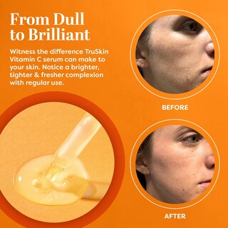 Foto 4 | Foto 4 | Suero De Vitamina C Skincare Truskin De 30 Ml Y Exfoliante Líquido De 125 Ml - Venta Internacional.