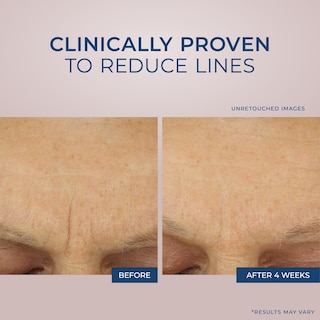 Foto 3 | Foto 3 | Crema Hidratante Roc Retinol Correxion Max Daily Hydration 50 Ml - Venta Internacional.