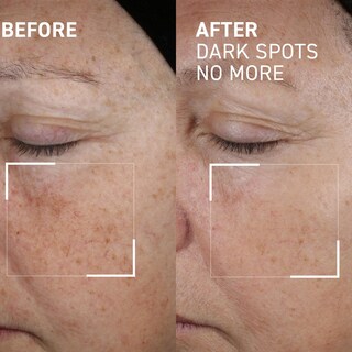 Foto 2 | Foto 2 | Concentrado Minimizador De Manchas Dr. Brandt Bright This Way, 15 Ml - Venta Internacional.